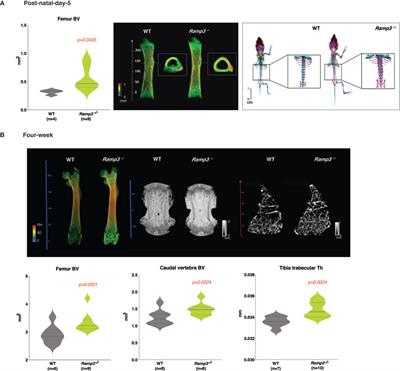 Accelerated Development With Increased Bone Mass and Skeletal Response to Loading Suggest Receptor Activity Modifying Protein-3 as a Bone Anabolic Target